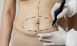 Vücut Şekillendirmede Etkili Bir Yöntem Liposuction